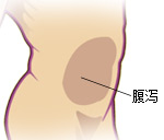 腹泻的发病基础