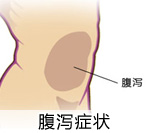 婴幼儿秋季腹泻症状