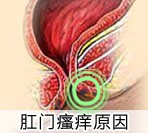 引起肛门瘙痒的两方面因素