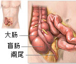 急性卡他性直肠炎治疗