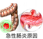 急性肠炎的发病原因是什么