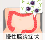 慢性结肠炎的症状表现有哪些