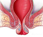 肛管直肠脱垂概述