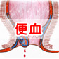 大便出血可能是什么病引起的？