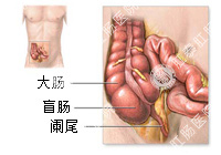 急性肠炎百科