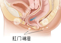 肛门潮湿百科